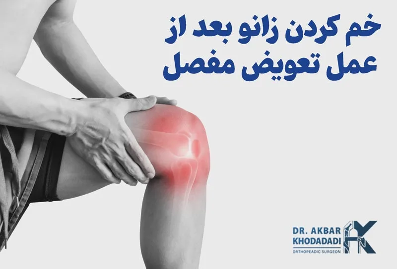 چقدر زانو خود را بعد از تعویض مفصل خم کنم؟